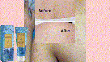 Cooling Moisturizer - Essential for Summer